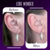 Lobe Wonder - The ORIGINAL Ear Lobe Support Patch for Pierced Ears - Eliminates the Look of Torn or Stretched Piercings - Protects Healthy Ear Lobes from Tearing - 120 Patches - Clear & Latex-Free view 3